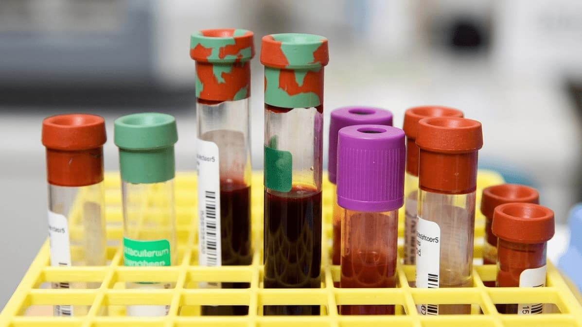 Imagen de Detectar cáncer con análisis de sangre es más cercano gracias a nuevo método